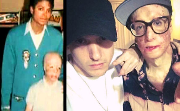EXCLUSIVE: Look Into The Heart Of Michael Jackson’s Friend Dave Dave Through The Eyes Of His Loving Friend Lil’ Eric